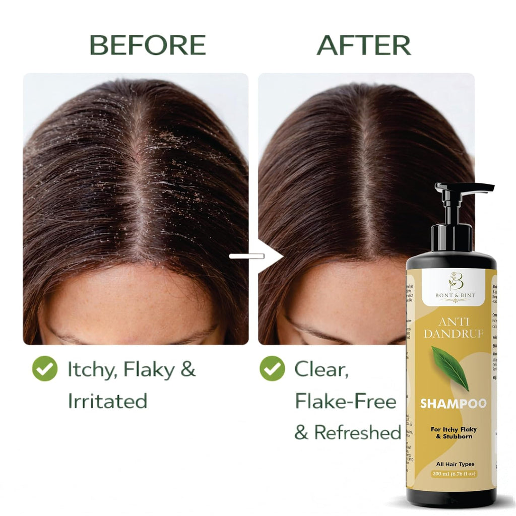 BONT & BINT Anti Dandruff Shampoo for Itchy & Flaky Scalp, Cleansing Formula for Freshness, Smoothness & Scalp Care, Daily Use for All Hair Types, 200ml