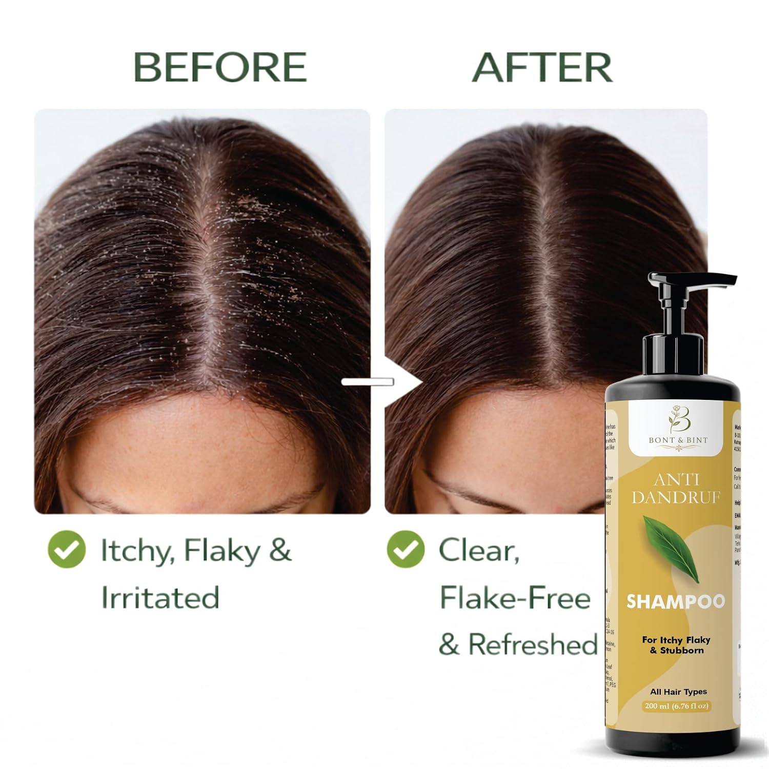 BONT & BINT Anti Dandruff Shampoo for Itchy & Flaky Scalp, Cleansing Formula for Freshness, Smoothness & Scalp Care, Daily Use for All Hair Types, 200ml