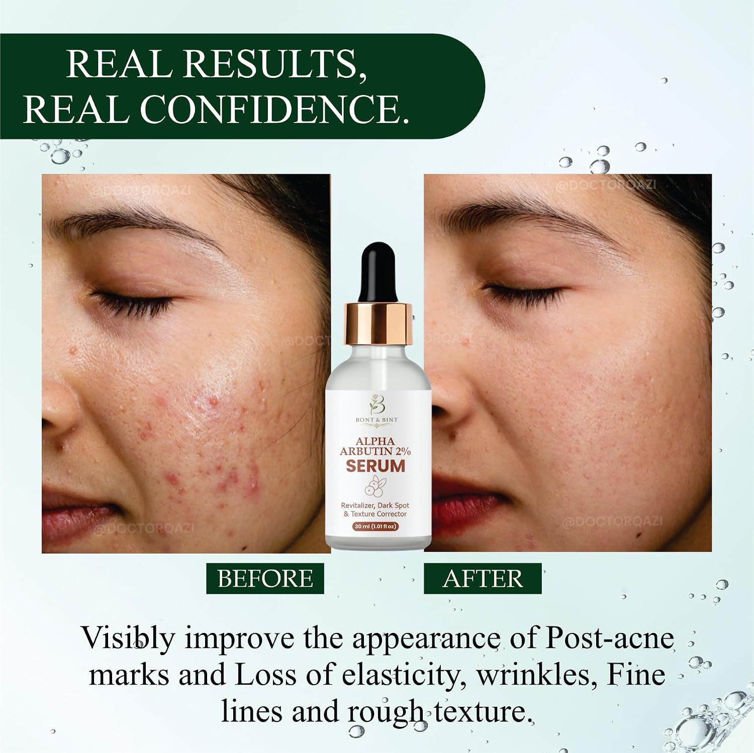 Alpha Arbutin 2% Facial Serum for Dark Spots, Hyperpigmentation & Uneven Skin Tone, Lightweight Brightening Serum for Smooth Texture, Daily Skin Revitalizer, 30ml