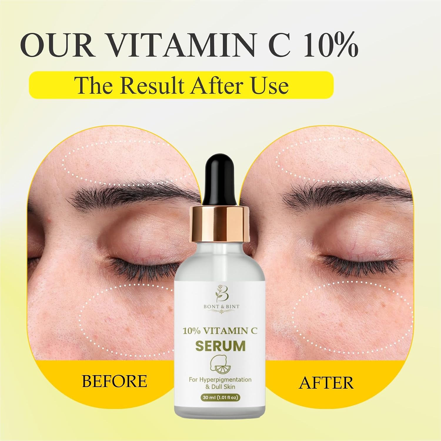 10% Vitamin C Face Serum for Brightening & Uneven Skin Tone, Antioxidant Facial Serum for Dull Skin & Dark Spots, Lightweight Hydrating Glow Serum for Daily Skincare, 30ml