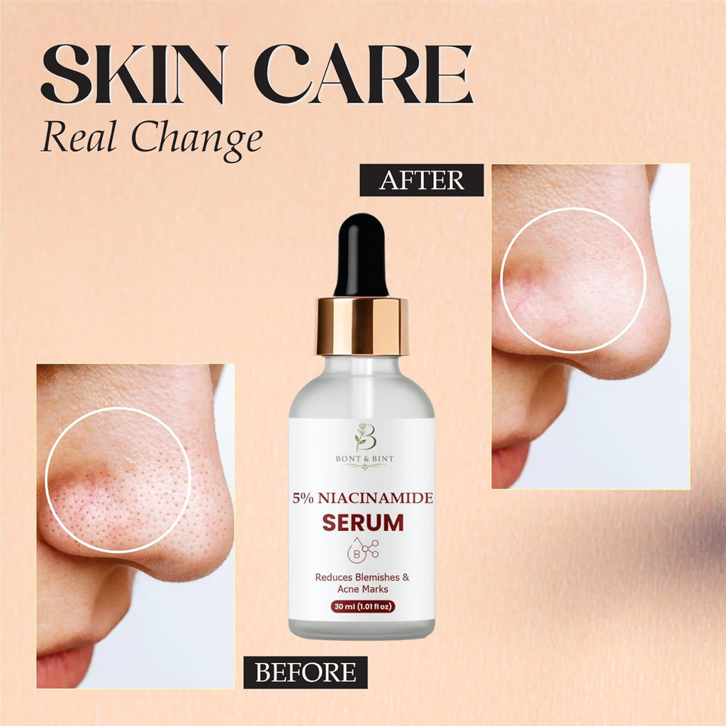 BONT & BINT 5% Niacinamide Face Serum for Blemish-Prone Skin & Uneven Tone, Lightweight Oil Control & Pore Minimizing Serum for Smooth Texture & Radiant Skin, 30ml