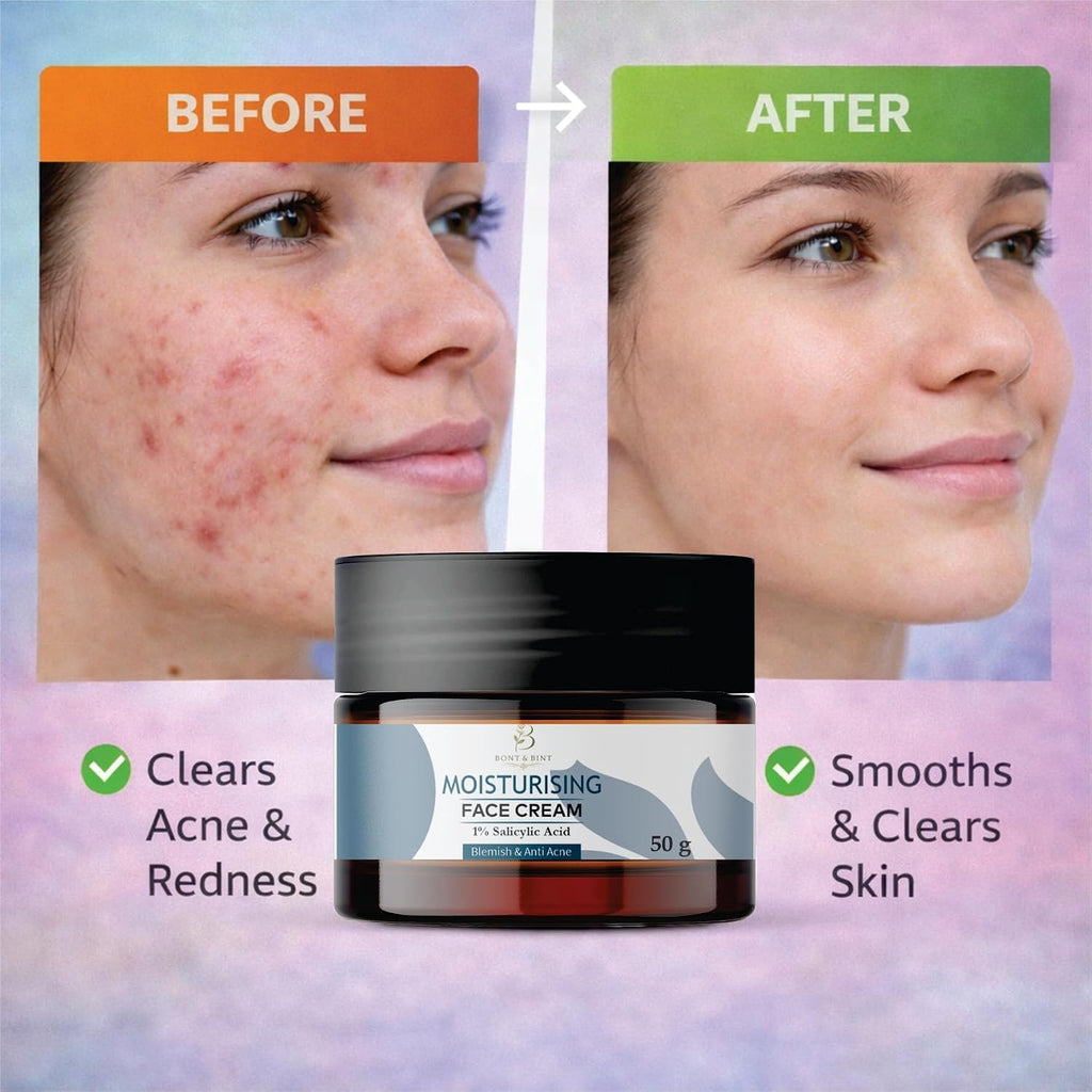 BONT & BINT Moisturising Face Cream with 1% Salicylic Acid for Blemish-Prone Skin, Lightweight Hydrating Anti Acne Face Moisturizer for Oil Control & Smooth Skin Texture, 50g