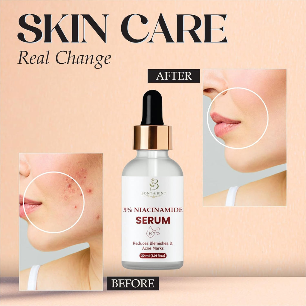 BONT & BINT 5% Niacinamide Face Serum for Blemish-Prone Skin & Uneven Tone, Lightweight Oil Control & Pore Minimizing Serum for Smooth Texture & Radiant Skin, 30ml